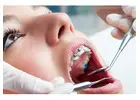 Teeth Whitening Winnipeg
