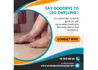 Swollen Legs Treatment in Coimbatore